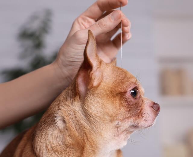 Acupuncture